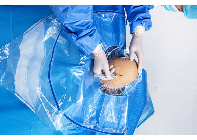 Ιατρικό αποστειρωμένο Craniotomy Drape χειρουργικό με το άνοιγμα 1pc/τη σακούλα