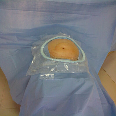 Χειρουργικά Πακέτα μιας χρήσης υψηλής απορροφητικότητας με ενισχυμένες απορροφητικές κρίσιμες ζώνες και αποστείρωση με EO για επείγοντα νοσοκομείου